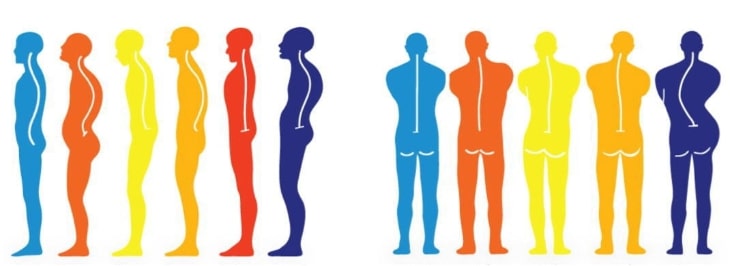 体の歪みや姿勢の崩れが肩こりや腰痛を引き起こす仕組みの図