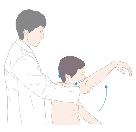 四十肩・五十肩確認