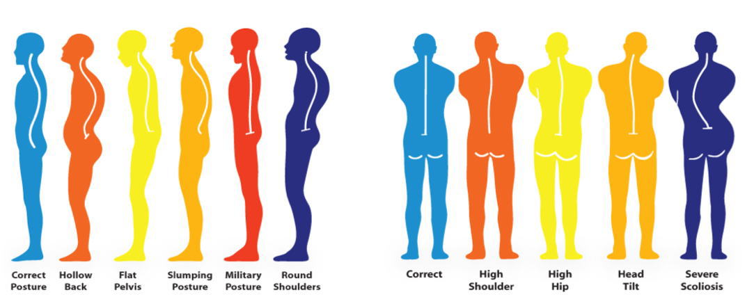 体の歪みや姿勢の崩れが肩こりや腰痛を引き起こす仕組みの図